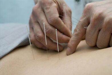 Acupuncture treats cartilage degeneration in the chest area