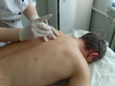 Injecting cartilage-protective drugs into the joint to treat cartilage degeneration in the chest area